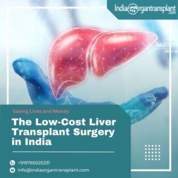 Best Doctors For Liver Transplant in India