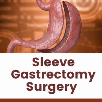Sleeve Gastrectomy Single Incision Cost India